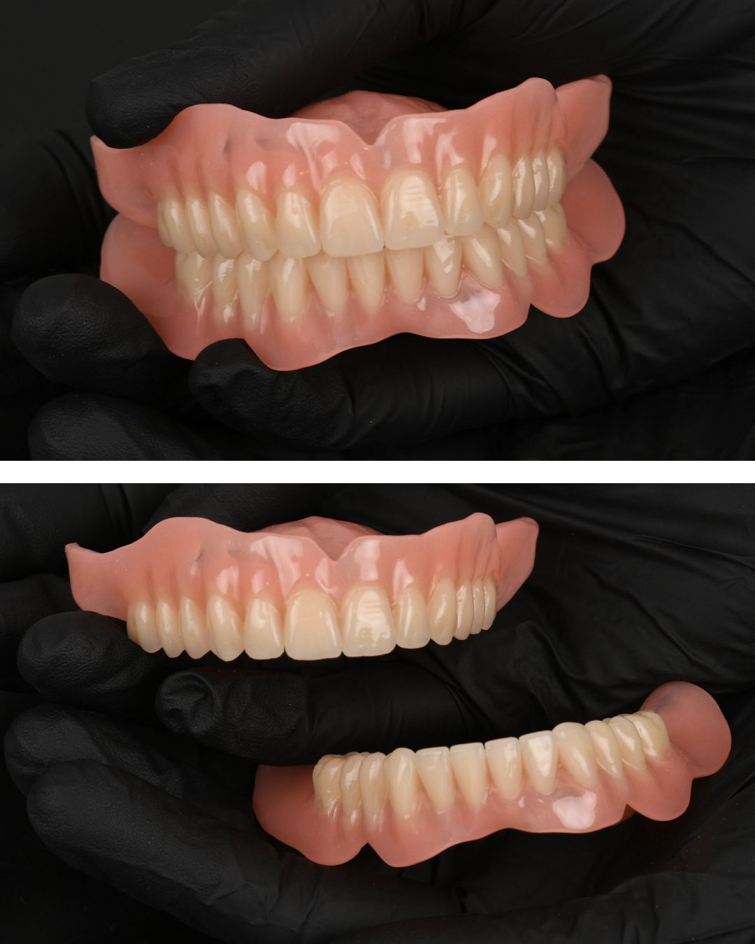 Zubne proteze prikazane s obje strane