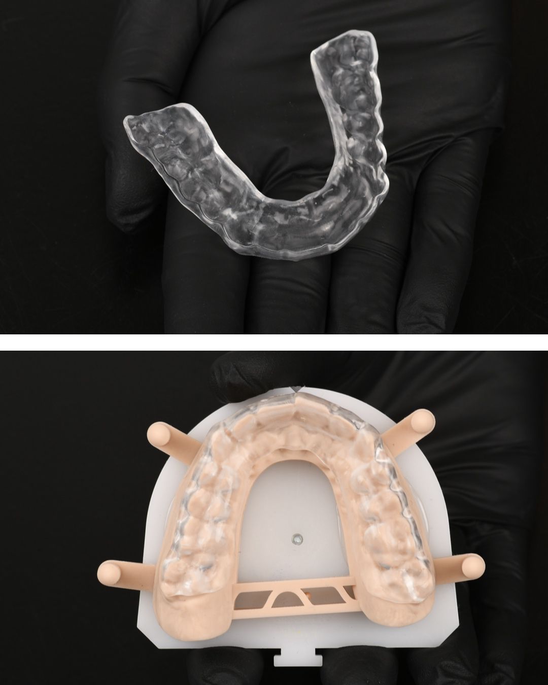 Udlaga za bruksizam protiv škripanja zubima
