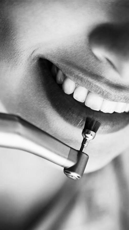 Prevencija kao ključ oralnog zdravlja