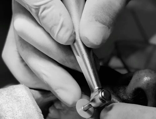 Osjetljivost zuba na hladno: najčešći razlozi i rješenja