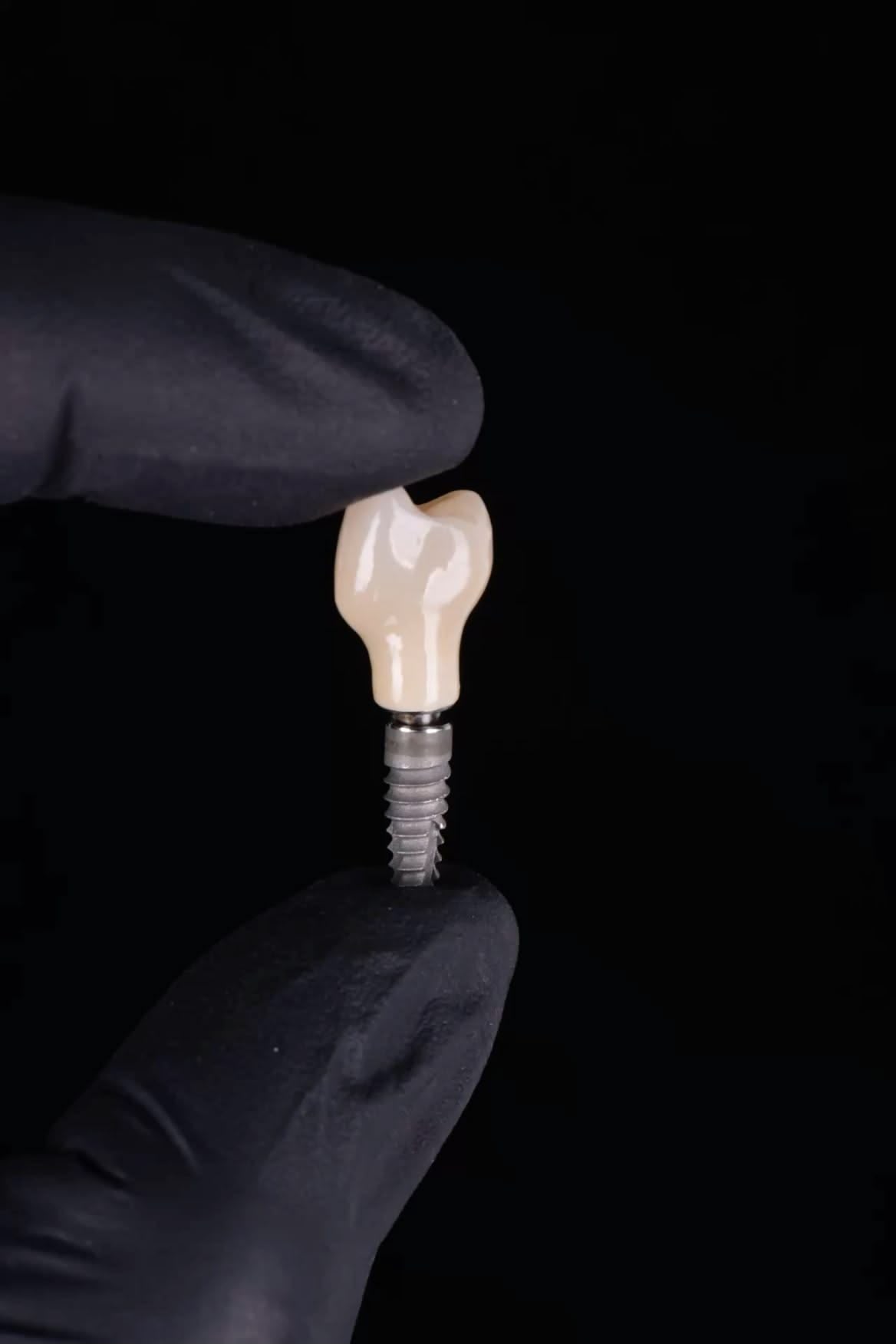 Dentalni implantat Nobel Biocare u ruci specijalista