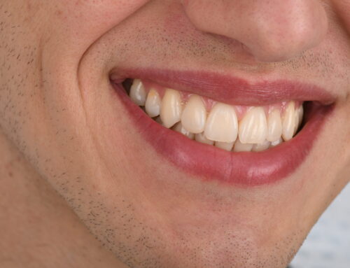 Uloga estetike u suvremenoj dentalnoj protetici
